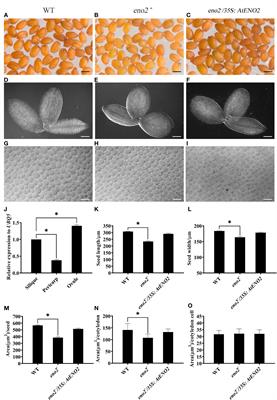 ENO2 Affects the Seed Size and Weight by Adjusting Cytokinin Content and Forming ENO2-bZIP75 Complex in Arabidopsis thaliana